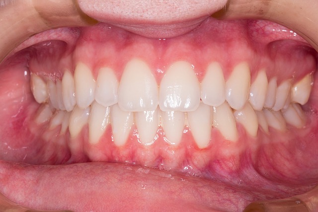 dental crown